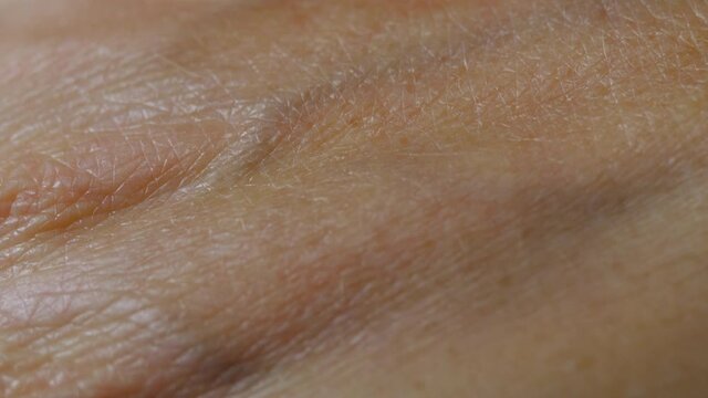 Macro Shot of Really Dry Old Human Skin. Close up Skin Texture With Wrinkles on Body Human Skin of Hand in Summer From Sunburn. Freckle Pigmentation Vein Allergy.