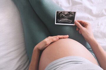 Pregnant woman looking at ultrasound image. Expectant mother with pregnant belly waiting for baby.