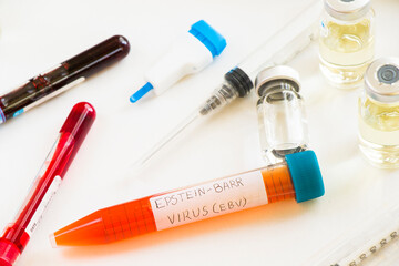 Mononucleosis and Epstein-barr virus blood test sample in lab on the white background