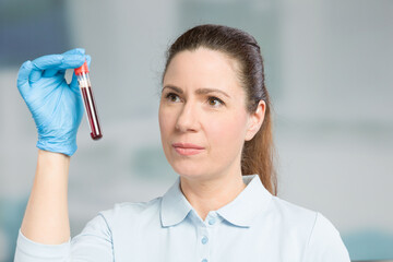 nurse or female scientist  with blood sample in a test tube in a laboratory