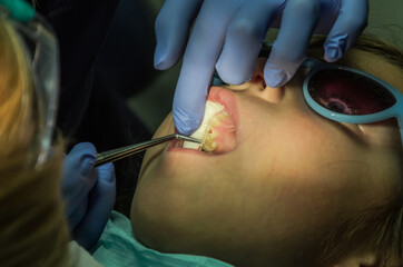 Children's dentist treats baby teeth	