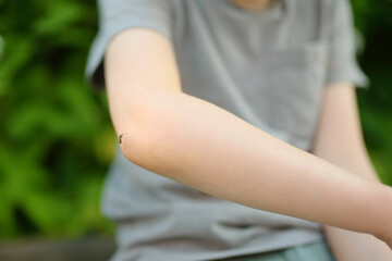 Mosquito sitting on the hand of child. Gnat sucking blood. Danger of bite of an insect. Use repellent for safety kids.