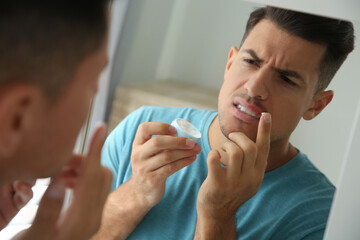 Man with herpes applying cream on lips in front of mirror at home - obrazy, fototapety, plakaty