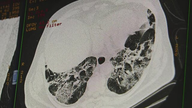 Multispectral computed tomography of the internal organs of a sick person.

