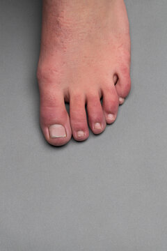 Single Foot With Covid Toes On A Gray Background