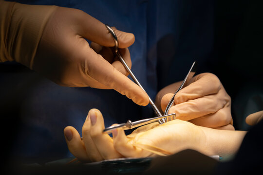 a surgeon operates a hand