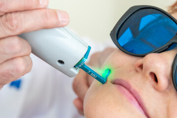 a dermatologist treats a patient's skin with a laser