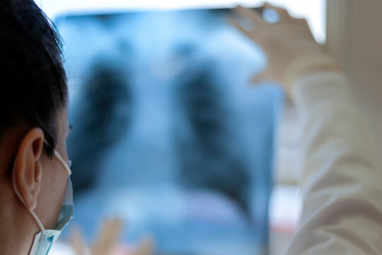 A female pneumologist holds a lung scan in her hands