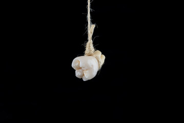 Tooth extracting method. Real human wisdom tooth hanging on thread