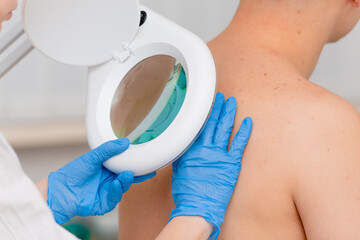 A dermatologist examines the skin on the body of a young man through a magnifying glass of a...