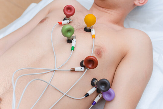 Cardiogram of the heart. The doctor attaches electrodes of an electrocardiograph to the patient&rsquo;s chest. Cardiology