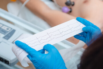 Heart cardiogram in the hands of a doctor close-up. Cardiologist is studying the testimony of an electrocardiograph.