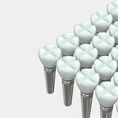 Tooth implant isolated on background. 3d rendering- illustration