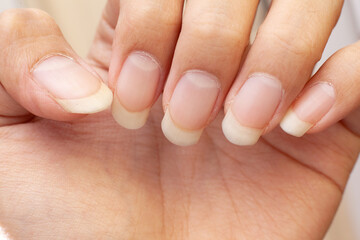 Hand Finger With Long Nail