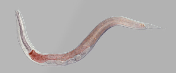 Nematode roundworm stained under the phase contrast microscope - obrazy, fototapety, plakaty