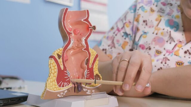 Proctologist points out the pathology of the rectum with a pencil to the anatomical model.