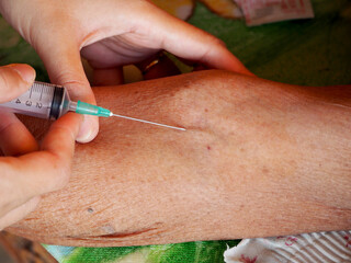 Hand preparing venous puncture of patient .Nurse collecting blood from arm vein of a patient. 