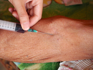 Hand collecting venous puncture of patient .Nurse collecting blood from arm vein of a patient. 