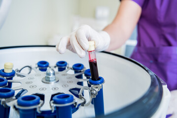 Platelet-Rich plasma preparation. Tube with blood in hands