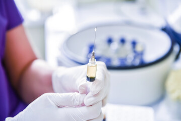 Platelet-Rich plasma preparation. Syringe with plasma in hands