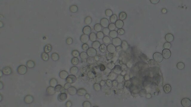 Microscopy of yeast cells (Saccharomyces cerevisiae). Monochrome background of granular cells moving.