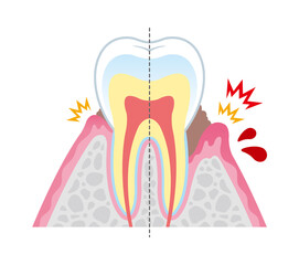 Tooth cross section_22