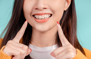 Dental Beautiful smiling of young asian woman with retainer braces glad emotion with white teeth increase confidence for healthy on blue background isolated, Happiness teenager facial expression. - obrazy, fototapety, plakaty