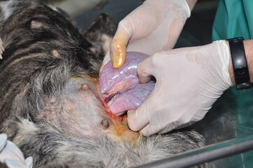 surgical operation to remove the uterus