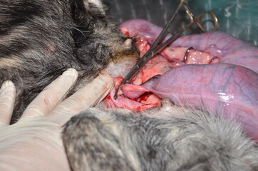 surgical operation to remove the uterus