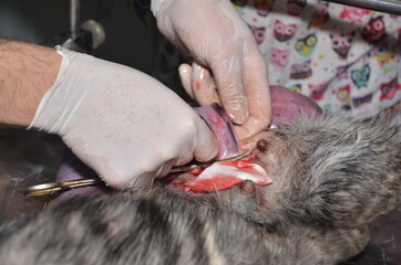 surgical operation to remove the uterus