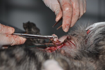 surgical operation to remove the uterus