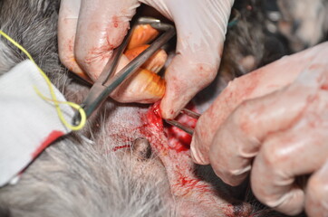 surgical operation to remove the uterus