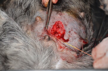 surgical operation to remove the uterus