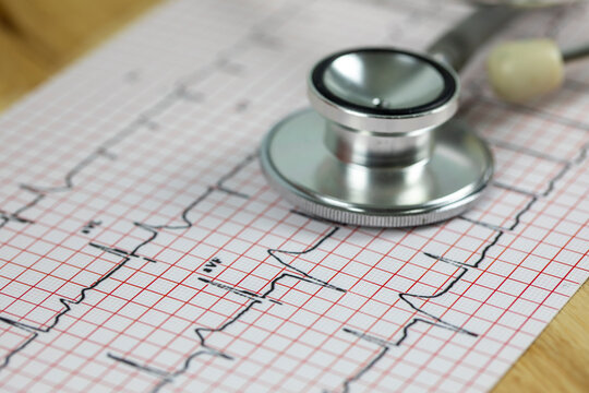 Heart attack concept, Stethoscope on the top of the ECG chart