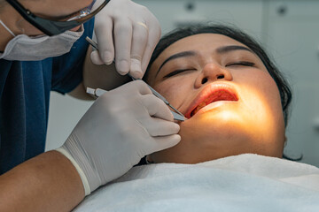 Close up photo of dentist doing dental treatment for patient 