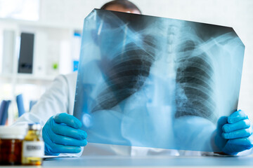 Doctor examining lungs x-ray scan in his office in hospital