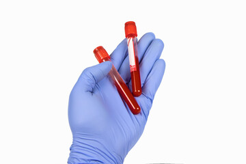 Hand holding test tube with blood plasma ready for testing