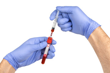 Doctor injecting a blood sample in a test tube analysis