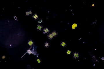 Protozoa and Green Algae in waste water under the microscope.
