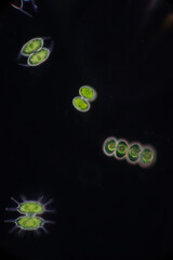 Protozoa and Green Algae in waste water under the microscope.
