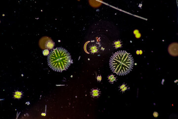 Protozoa and Green Algae in waste water under the microscope.

