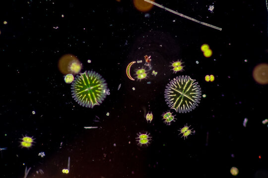 Protozoa and Green Algae in waste water under the microscope.
