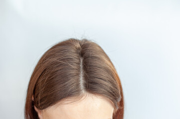 A woman's head with a parting of gray hair.