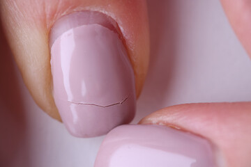 Closeup of broken nail on womans hand with manicure