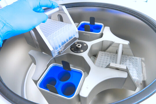 scientist puts the test tubes in centrifuge. Automation in the clinical laboratory. Pipetting robot laboratory. Research and science background