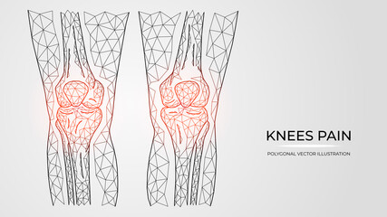 Polygonal vector illustration of pain, inflammation or injury in knees. Human legs bones anatomy. Medical orthopedic diseases templates.