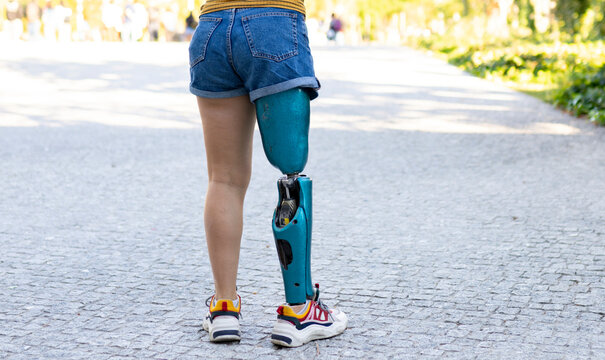 Back view of crop female in shorts with bionic artificial limb of leg standing on street in city
