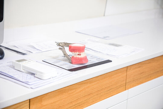 Closeup of white dental cast placed on white surface in modern laboratory
