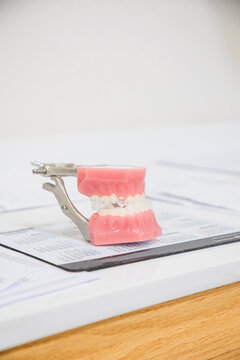 Closeup of white dental cast placed on white surface in modern laboratory