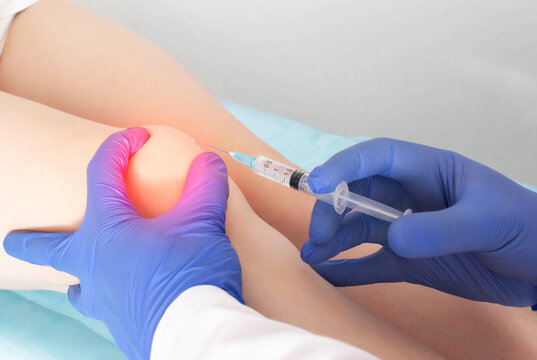 The Doctor Injects Injections With Hyaluronic Acid Into The Knee Joint Of A Patient Who Has Pain And Arthrosis In The Knee. Concept Of Joint Treatment With Chondroprotectors, Close-up